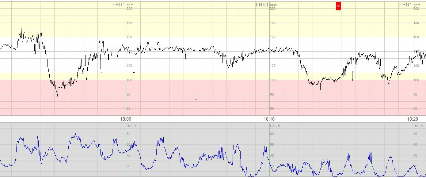 Vaerkregistrering ctg