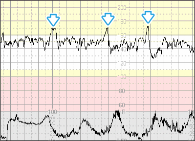 3 3 3 accelerationer