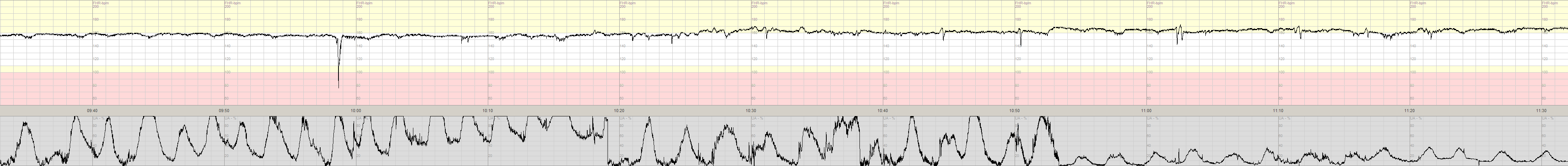 3 5 2 0933 1132 SGB2789