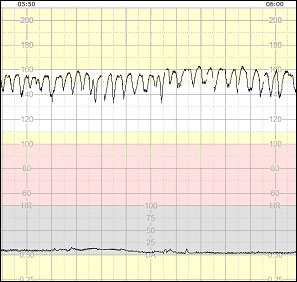 3 5 5 sinusoidalt monster