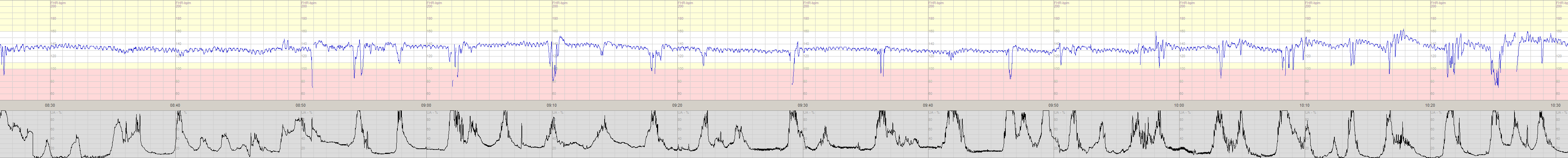 3 5 6 0827 0850 SGA 0343