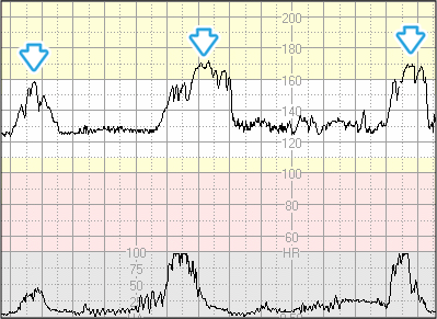 3 6 1 accelerationer