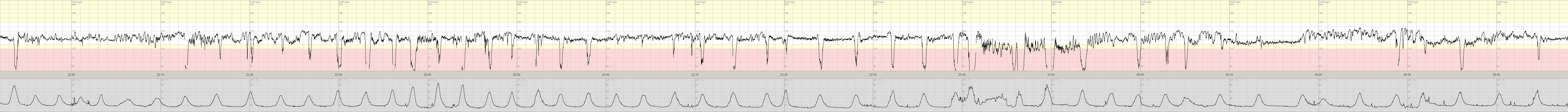 3 7 5 2152 0048 GAA0158