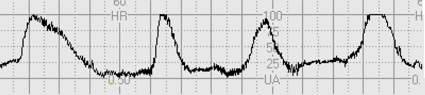 3 8 1a varkregistrering frekven