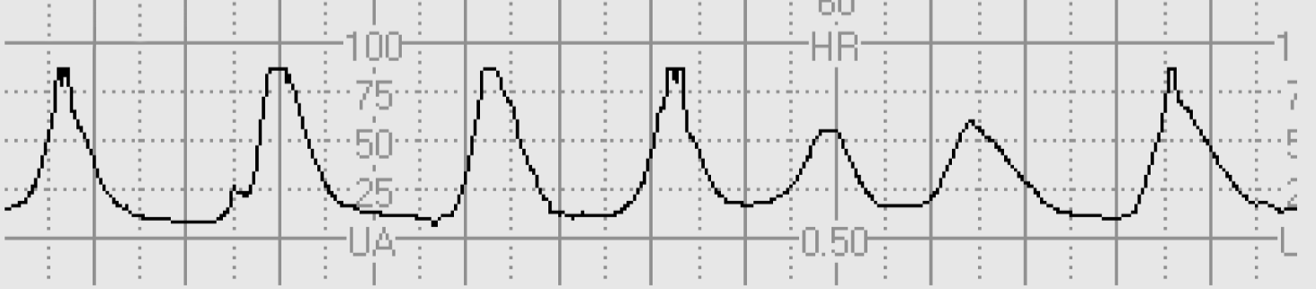 3 8 1c varkregistrering basaltonus